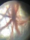 [TodoMarino.com] Identificar alga