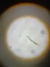 [TodoMarino.com] ¿ Es Cianobacateria verde o microalgas vivas?