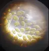 [TodoMarino.com] montipora plato blanqueando