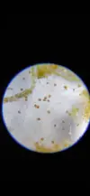 [TodoMarino.com] Ostreopsis sp, la madre de todas las pestes