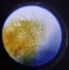 [TodoMarino.com] Ostreopsis sp, la madre de todas las pestes