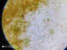 [TodoMarino.com] Ostreopsis sp, la madre de todas las pestes