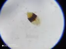 [TodoMarino.com] Ostreopsis sp, la madre de todas las pestes