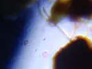 [TodoMarino.com] ataque por fondo y superficie (sugerencias identificación)