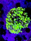 [TodoMarino.com] Zoas , euphilias y sps