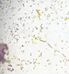 [TodoMarino.com] ¿Que puede pasarle a esta pachyclavularia?