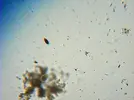 [TodoMarino.com] Ostreopsis sp, la madre de todas las pestes