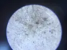 [TodoMarino.com] Plaga de algas filamentosas y marrones