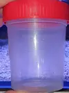[TodoMarino.com] Vendo anemonas cuadricolor  alga chaeto tambien.  Xeraco valencia